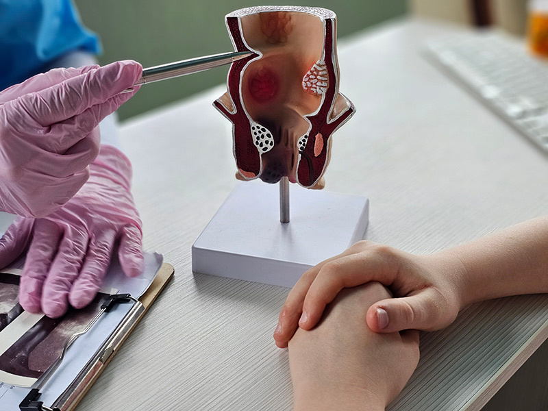 Colorectal surgeon explaining anal fistula repair to patient during consultation.